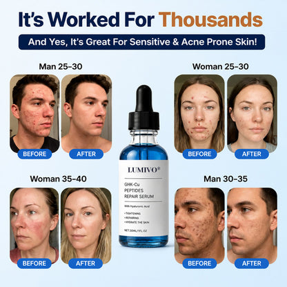 GHK-Cu Peptides Repair Serum for Firmer, Younger-Looking Skin.