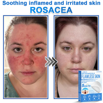 🎁 SkinPrikyn™ 2-in-1 Microneedle & Hydrocolloid Patch