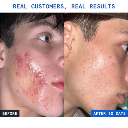 GHK-Cu Peptides Repair Serum for Firmer, Younger-Looking Skin.