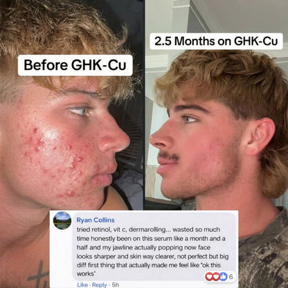 GHK-Cu Peptides Repair Serum for Firmer, Younger-Looking Skin.